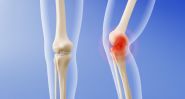 Smart Cartilage: The New Frontier Against Arthritis?