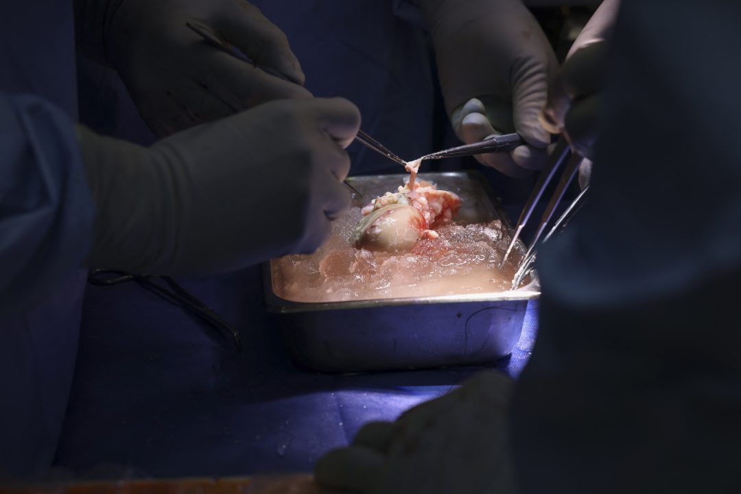 Pioneering Pig Kidney Transplant Succeeds