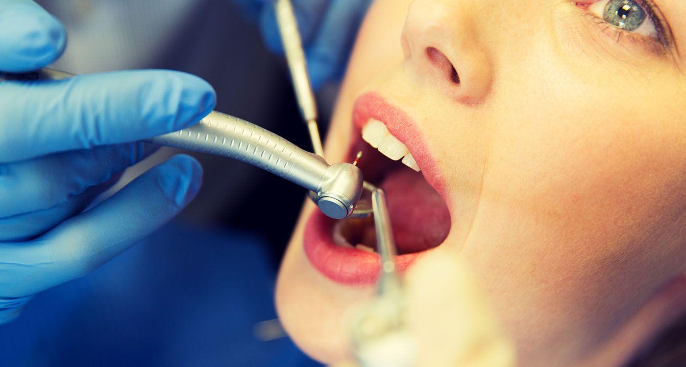 Un vaccin contre les caries? Des chercheurs franchissent un cap