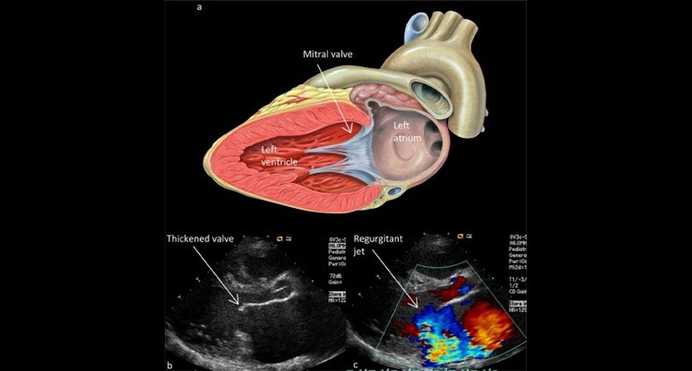 Cœur: opérer mieux, plus vite — l’héritage DeBakey, la trajectoire libanaise