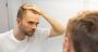 SCUBE3: The Molecule That Promises to Awaken Sleeping Hair